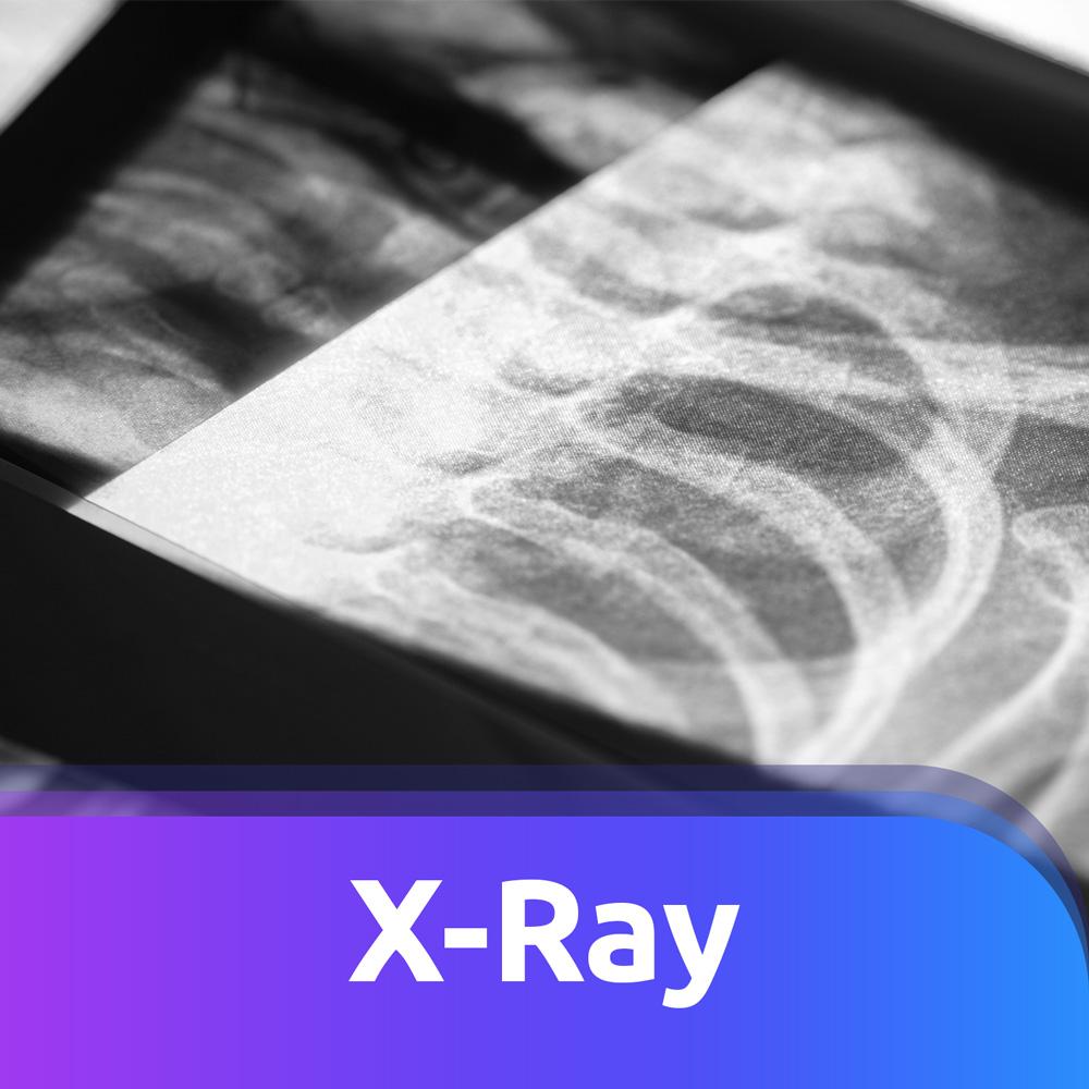 raynex x-ray